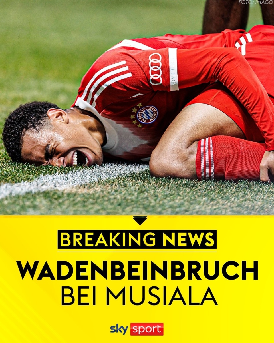 开云体育-穆尔西亚队员集体受伤，阵容将面临严重考验